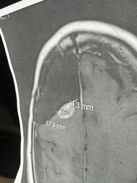 Medical scan dated January 16 following prolonged high-THC use